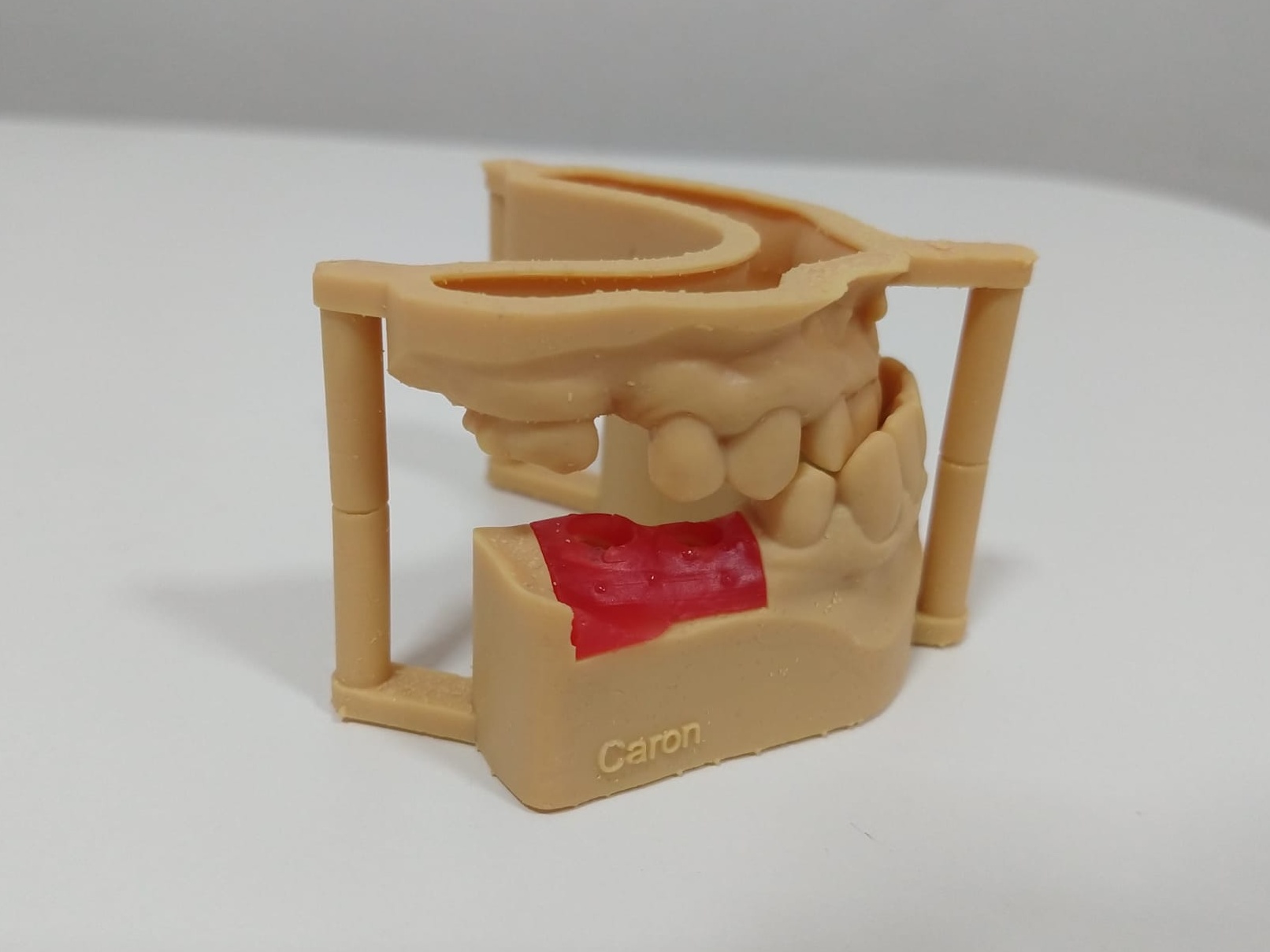 3D Printing Limburg | https://www.3dprintinglimburg.nl/files/afbeeldingen/portfolio/Gingiva Mask Cropped.jpg